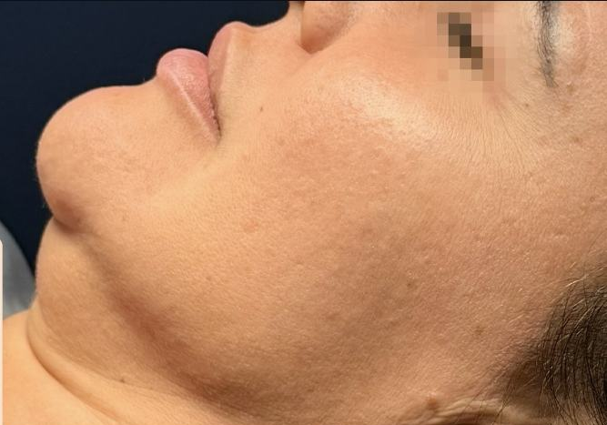 Resultado — Dra. Aline Esmeraldino | E.Clinic Orofacial