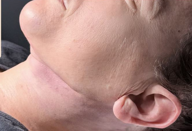 Resultado — Dra. Aline Esmeraldino | E.Clinic Orofacial
